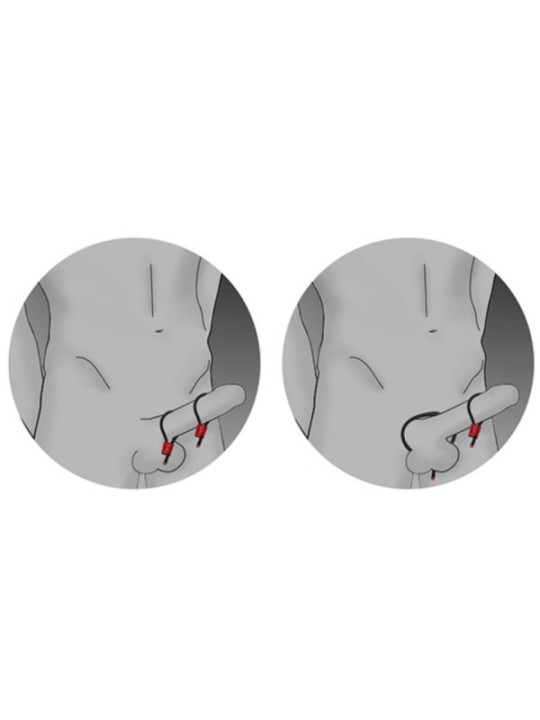 ELECTRASTIM - PRESTIGE ELECTRA LOOPS ANNEAUX PÉNIENS RÉGLABLES ROUGES